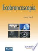 Descargar el libro libro Ecobroncoscopia