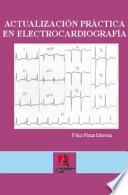 Descargar el libro libro Actualización Práctica En Electrocardiografía